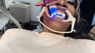 Pt1: Invisalign Procedure from Start to Finish
