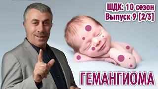 Гемангиома - Доктор Комаровский