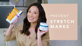 How I Prevent Stretch Marks with Body Skincare Products | Susan Yara
