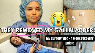 My gallbladder removal surgery experience + 1st week post-op! (PAINFUL😣, EMBARRASSING😳& REAL🫣!)