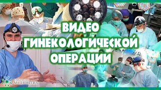 Реимплантация левого мочеточника по поводу мочеточниково-влагалищного свища