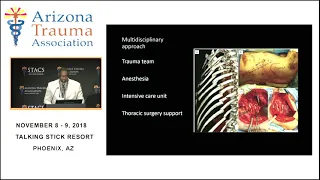 Updates on Rib Fixation-- Presented at  STACS 2018