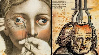 10 Weirdest Medical Practices From Medieval Times!