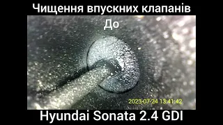 Hyundai Sonata 2,4. Пропуски воспламенения в первом цилиндре. Решено.