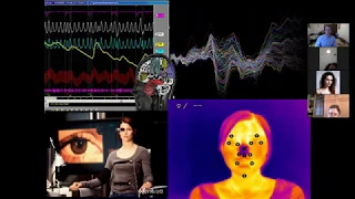 БОС-терапия в МГУ. Лекция о технологиях с биологической обратной связью