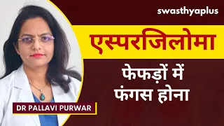 फेफड़ों में फंगस होना: पता कैसे लगाएं? | Pulmonary Aspergilloma in Hindi | Dr Pallavi Purwar