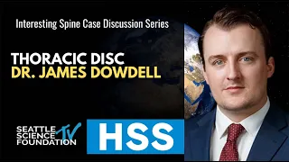 Thoracic Disc Herniation - James Dowdell, M.D.