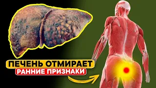 Признаков того, что ваша ПЕЧЕНЬ ОТМИРАЕТ. 90% с проблемами печени даже не знают об этом