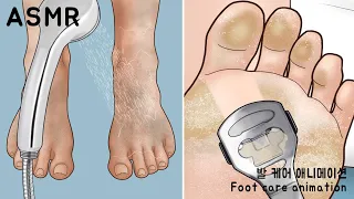 ASMR So Satisfying! | Homeless foot care animation | CALLUS REMOVAL 