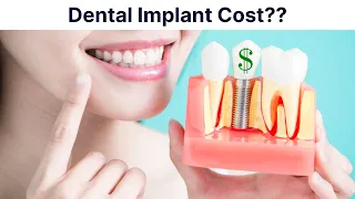 How Much Do Dental Implants Cost? Are They Worth It?