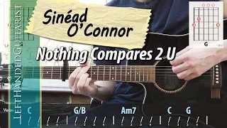 Sinéad O'Connor - Nothing Compares 2 U | acoustic guitar lesson