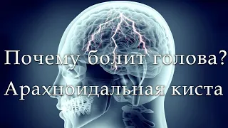 Что такое арахноидальная или арахноидная киста? Янис Шлезиньш, нейрохирург, Доктор медицинских наук