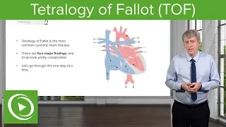 Tetralogy of Fallot (TOF) – Pediatrics | Lecturio