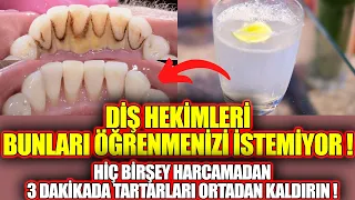 Dişlerinizdeki Tartarları 3 Dakikada Ortadan Kaldıran Yöntem