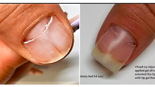 Nail Injury / FIXED for Now / SEE HOW - Using My Natural Color Gel ---For Sale now  !