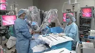 Robotic Gastric Bypass