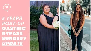 5 Year Gastric Bypass Surgery Update