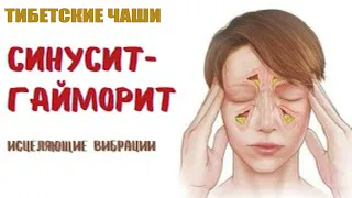 СИНУСИТ - ГАЙМОРИТ💡ТИБЕТСКИЕ ЧАШИ💡МЕДИТАЦИЯ