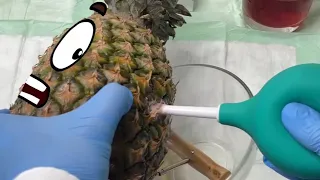 Fruitsurgery (WORLD OF DOODLES) | Pineapple needs surgical operation | Funny video with Doodles