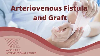 What are Arteriovenous Fistula and Arteriovenous Grafts