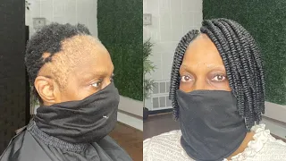 She wanted to conceal her alopecia with a natural hairstyle.