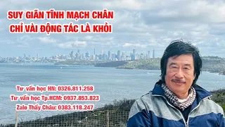 Suy giãn tĩnh mạch chân, dễ dàng chữa khỏi với vài động tác