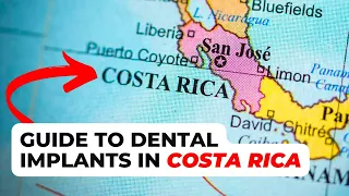 5 Things To Know About Dental Implants in Costa Rica