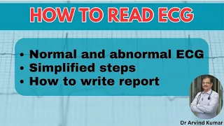 Mastering ECG Reading || Simplified Guide for Interns, General Practitioners, and Medicine Residents