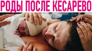 РОДЫ ПОСЛЕ КЕСАРЕВА СЕЧЕНИЯ | 10 мифов о родах с рубцом на матке