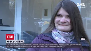 Жительці Києва з генетичною хворобою херувізм лікарі подарували нову усмішку | Новини України