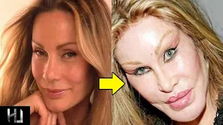 Top 10 Celebrities that turned into monsters before and after | 💘 HoOked UP