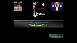 Gynecological Ultrasound -Lecture 06 -Miscellaneous  Gynecological Topics