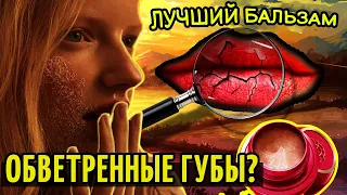 СТРАДАЕШЬ ОТ ОБВЕТРЕННЫХ ГУБ?  ЭТОТ БАЛЬЗАМ ИСЦЕЛИТ ТВОИ ГУБЫ