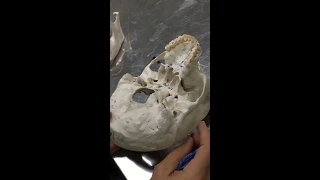 Practical osteology  5 ( skull , norma  basalis externa ), by Dr. Wahdan