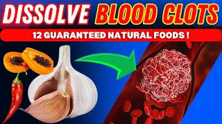 TOP 12 FOODS that Dissolve BLOOD CLOTS