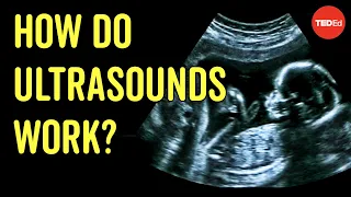 How to see with sound - Jacques S. Abramowicz