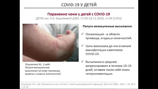 COVID-19 у детей