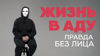 Без лица: жизнь в аду