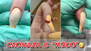 Сломала ноготь в мясо / Сломала ноготь / Сломала ноготь что делать  / Маникюр