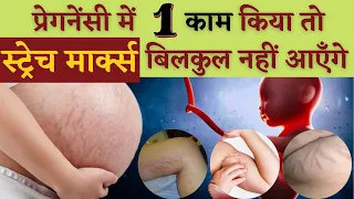 प्रेगनेंसी में ये 1 काम किया तो स्ट्रेच मार्क्स बिलकुल नहीं आयेंगे | STRECH MARKS IN PREGNANCY