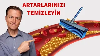 İşte atardamarlarınızı temizlemek için yapmanız gereken ilk 5 şey | Dr.Berg Türkçe