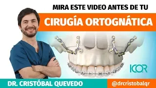 Cirugía Ortognática - Todo lo que necesitas saber [Antes y después de operarte]