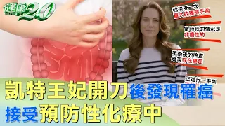 凱特王妃腹部開刀後發現罹癌 接受預防性化療中 健康2.0 @tvbshealth20