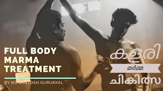 Full Body Marma Treatment  By ND Santhosh Gurukkal. Brahmmodayam Kalari.