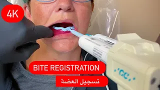 BITE REGISTRATION / تسجيل العضة (عربي وانجليزي)