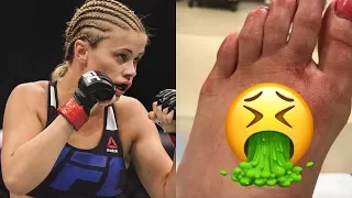 OUCH! UFC Fighter Paige VanZant Shows Off Disgusting Foot Injury