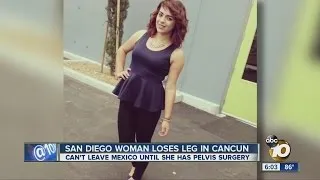 San Diego woman loses leg in Cancun accident