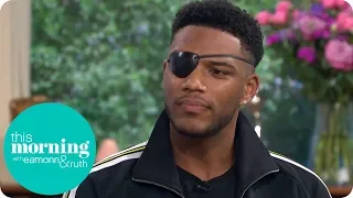 Love Island's Theo on the Champagne Cork Accident That Left Him Blind in One Eye | This Morning