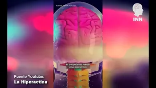 Se puede operar el CEREBRO de un paciente DESPIERTO? /  Aporte Especial INN