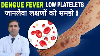 DENGUE FEVER LOW PLATELETS जानलेवा लक्षणों को समझे ! || Dr kumar education clinic